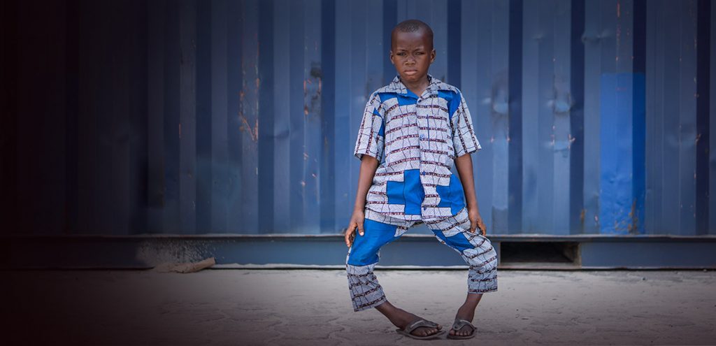 maurinho patient mercyships orthopedie kromme beentjes gratis operatie header