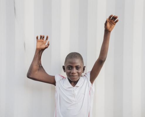 David en de verbrande huid op zijn arm