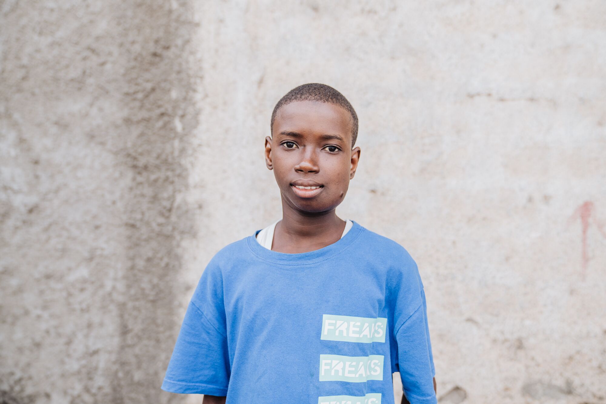 SLF240307_IBRAHIM_SLF09561_BEFORE_TT001_HI-MID SLF240307 IBRAHIM SLF09561 BEFORE TT001 HI MID