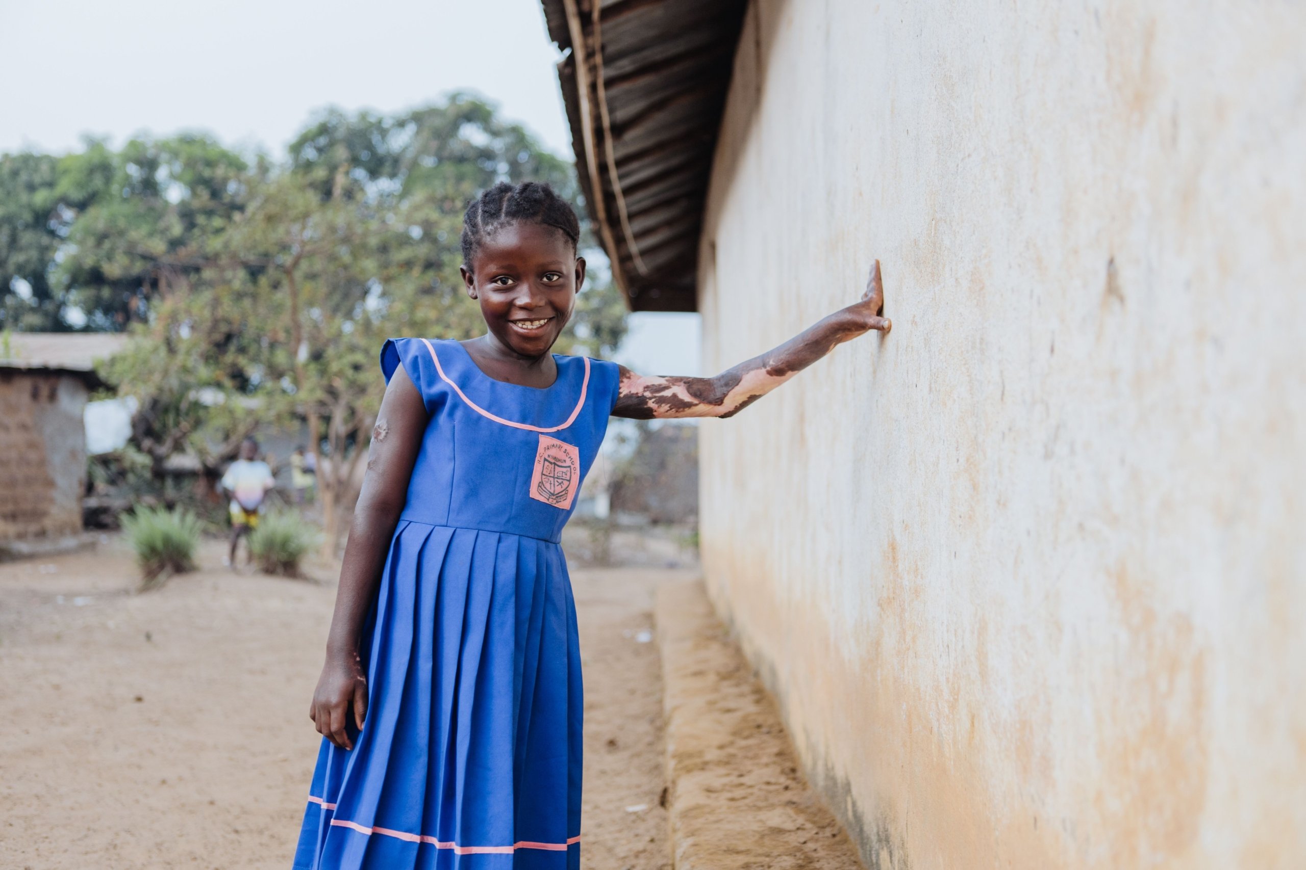 SLG250227 MUSU SLG09363 AFTER HOMEVISIT MVP023 HI 1 scaled